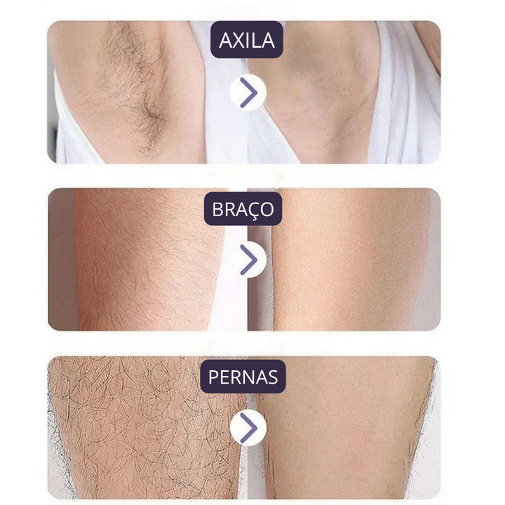 Depilador antiirritación SkinLiss